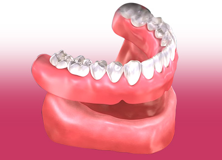 PROSTHETIC TREATMENT